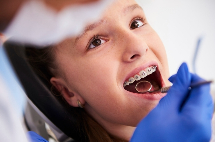 Orthodontic Braces, Ramesh Dental Care, Dr. Ramesh Garikapati