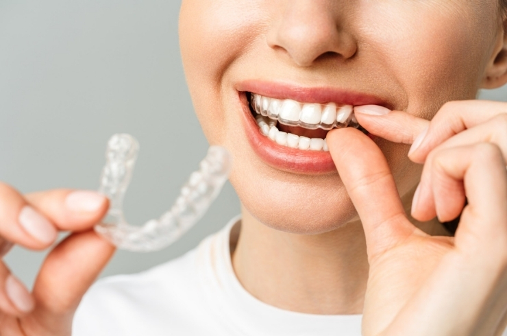 Invisible Braces, Ramesh Dental Care, Dr. Ramesh Garikapati