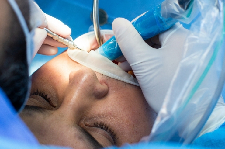Advanced Dental Implants